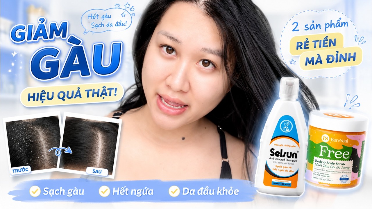 Tuyệt chiêu cho những ai bị gàu từng mảng, ngứa da đầu